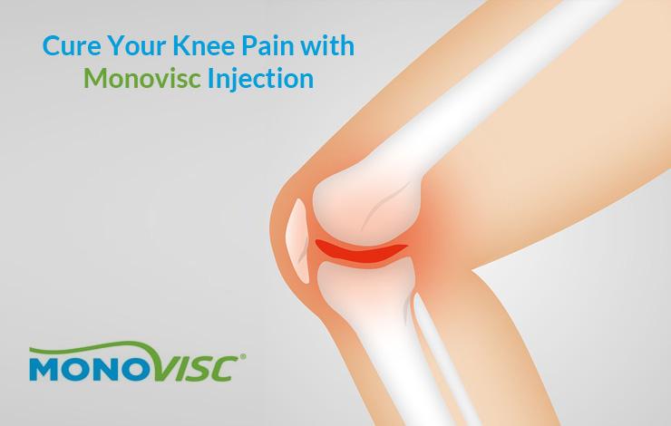 Cure Your Knee Pain with Monovisc Injection
