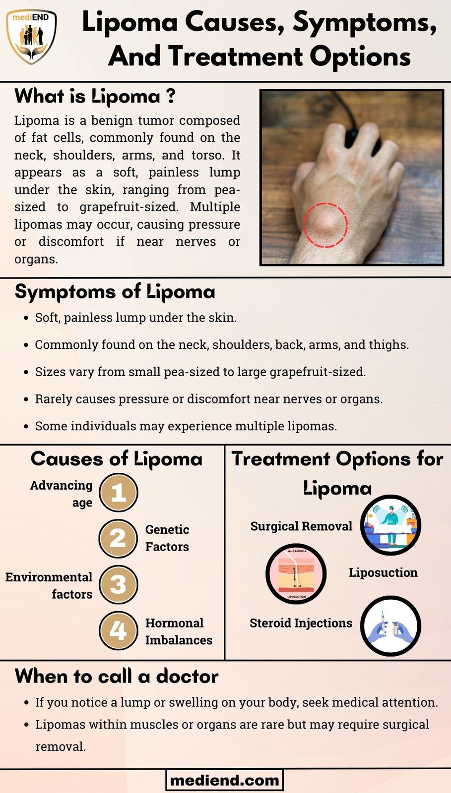 Lipoma Causes, Symptoms, And Effective Prevention Methods