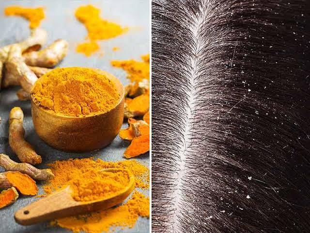 What are the benefits of turmeric to get rid of dandruff? - Care Beauty